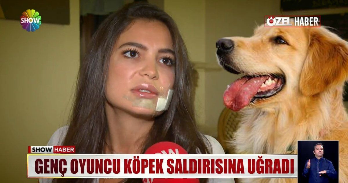 Oyuncu Hazal Erişkin'den kendisini ısıran köpeğin sahibine dava - Sayfa 8