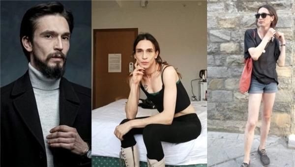 Trans birey olduğunu açıklayan Ahmet Melih Yılmaz, değişim için ilk ameliyatını oldu - Sayfa 2