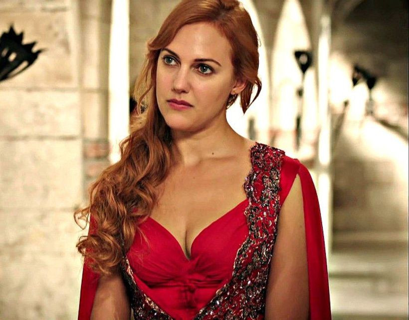 Meryem Uzerli estetik kurbanı oldu: Görenler tanıyamadı - Sayfa 22