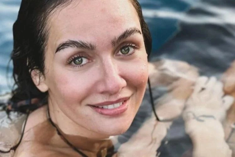 'Doğal güzel' denmişti: Birce Akalay'ın estetiksiz hali şaşırttı - Sayfa 6