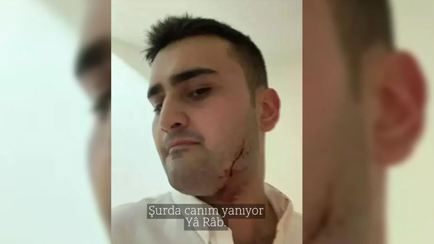 CZN Burak'ın vücudu kesikler içinde! Son hali herkesi korkuttu - Sayfa 4