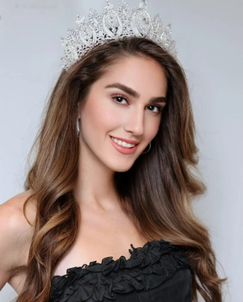 Miss Turkey birincisi İdil Bilgen'in son hali tartışma yarattı - Sayfa 7