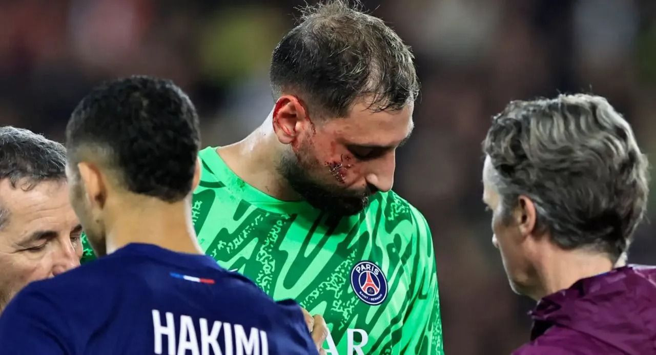 PSG'nin kalecisi Donnarumma'nın yüzü parçalandı: İşte o pozisyon - Sayfa 3