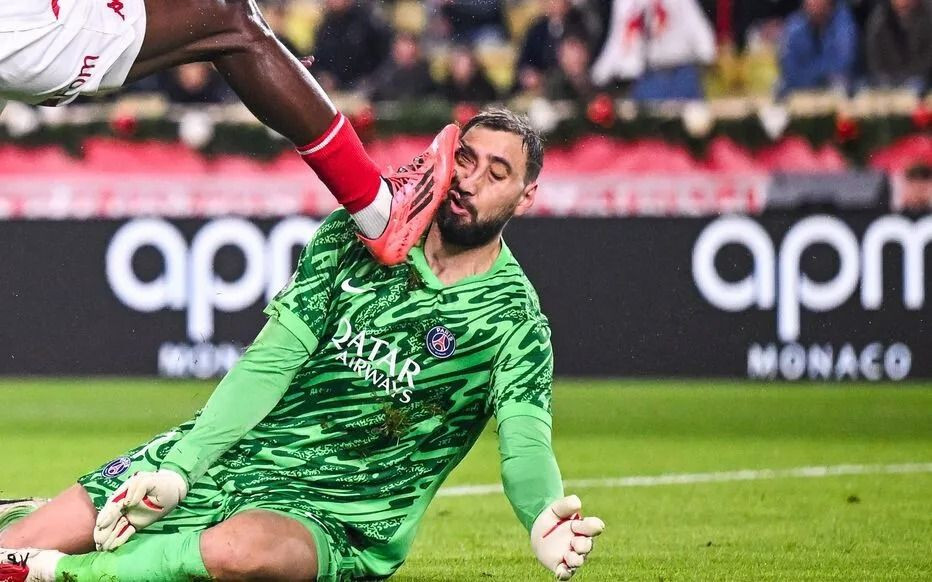 PSG'nin kalecisi Donnarumma'nın yüzü parçalandı: İşte o pozisyon - Sayfa 4