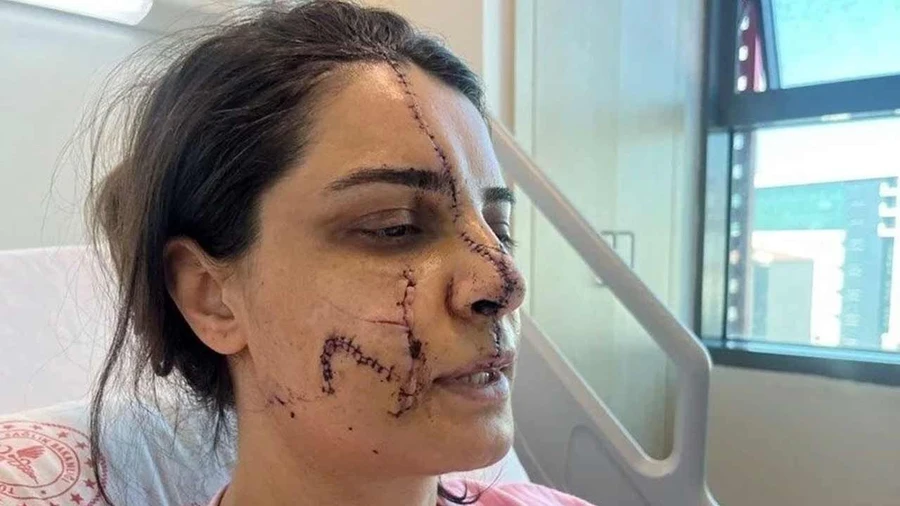 Marmaray'daki vahşette pes dedirten savunma! - Sayfa 3