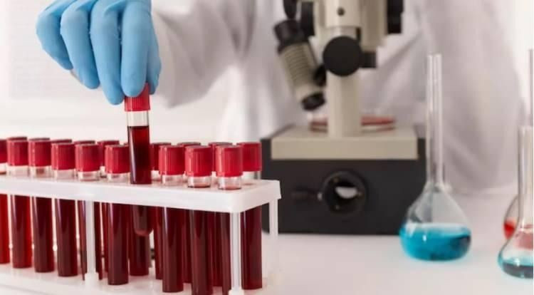 Japon bilim insanları son noktayı koydu! İşte en zeki kan grubu, hepsinden farklıymış - Sayfa 1