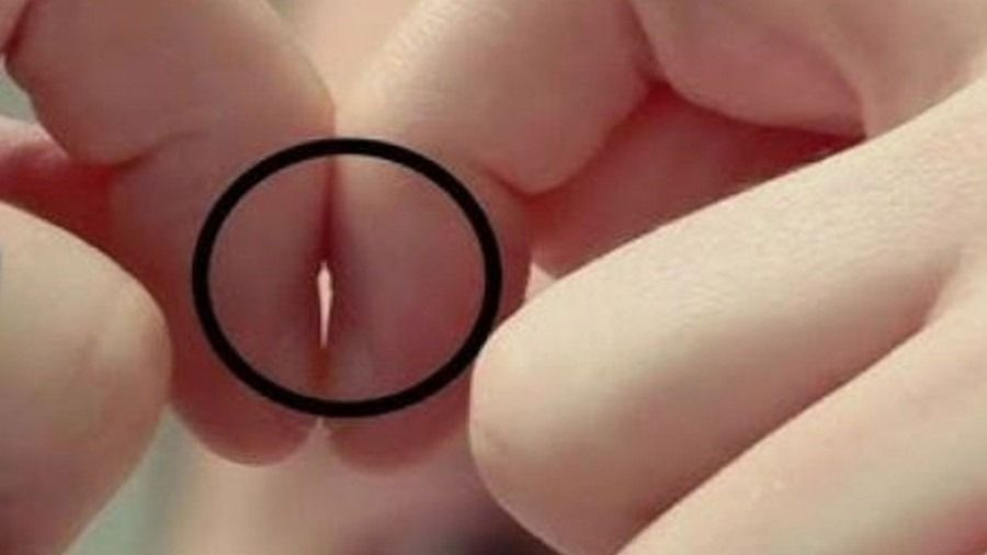 Hastalıklarınızı öğrenebilirsiniz... Parmak testi ölüm riskiniz hakkında uyarı veriyor - Sayfa 2