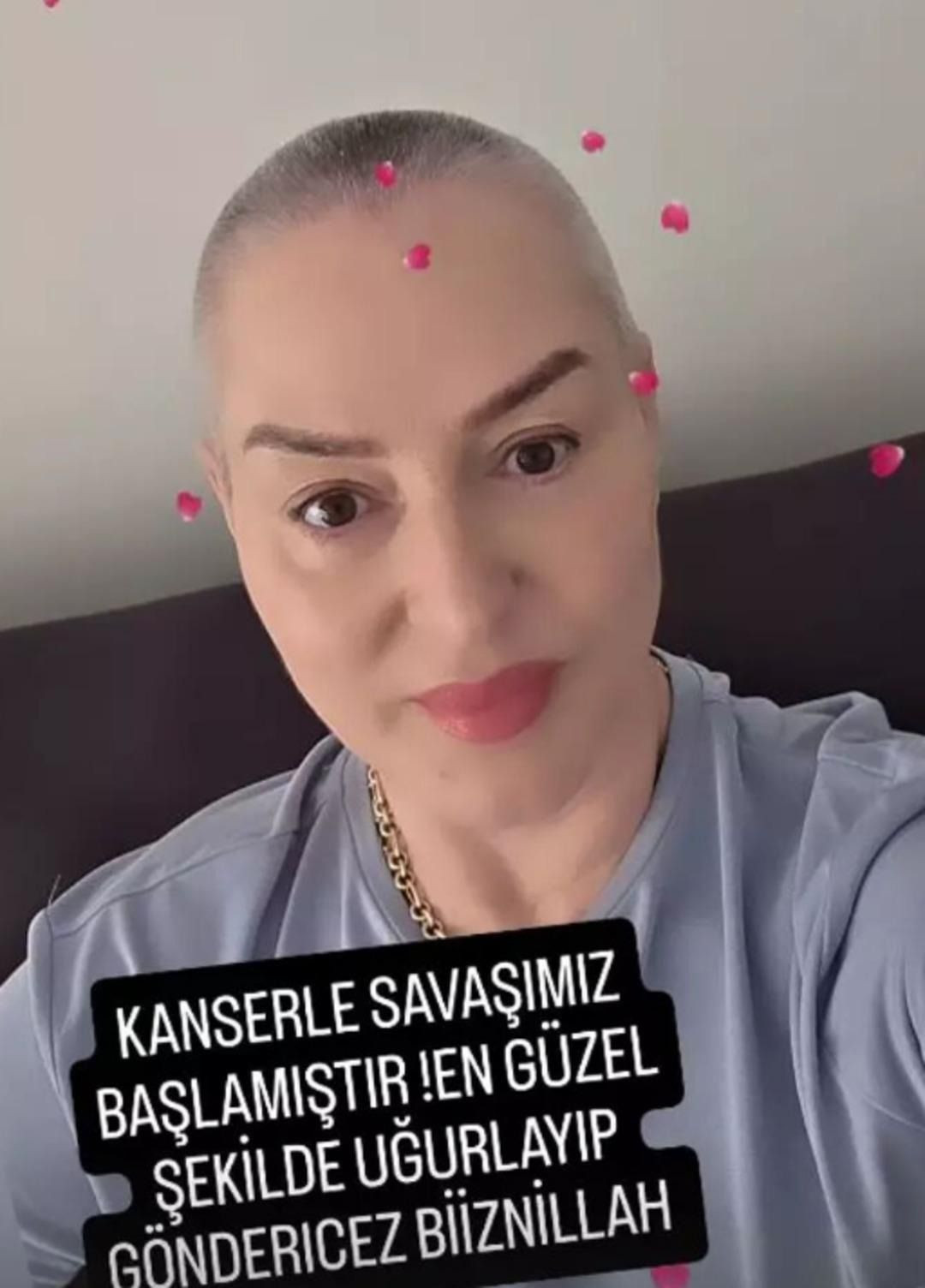 Cerrahpaşalıların Ablasıydı... Şıvga Gerez'den üzen paylaşım! Saçlarını kazıtıp.. - Sayfa 7