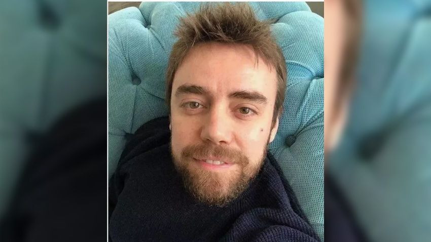 11 kez burun ameliyatı olmuştu! Ünlü şarkıcı Murat Dalkılıç'ın son hali ortaya çıktı - Sayfa 2