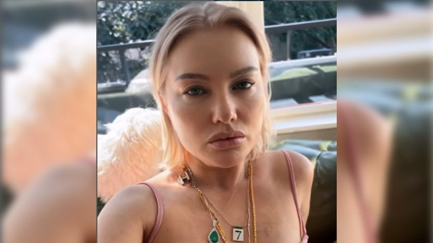 Hilal Cebeci'nin son hali olay oldu! Görenler tanıyamadı... - Sayfa 3