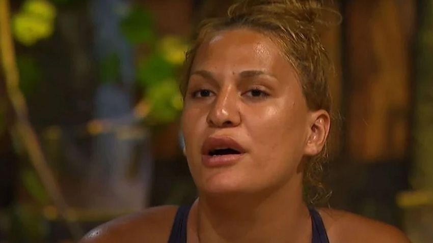 Survivor'dan diskalifiye edilmişti... Almeda Baylan’dan estetik sonrası ilk kare... - Sayfa 1