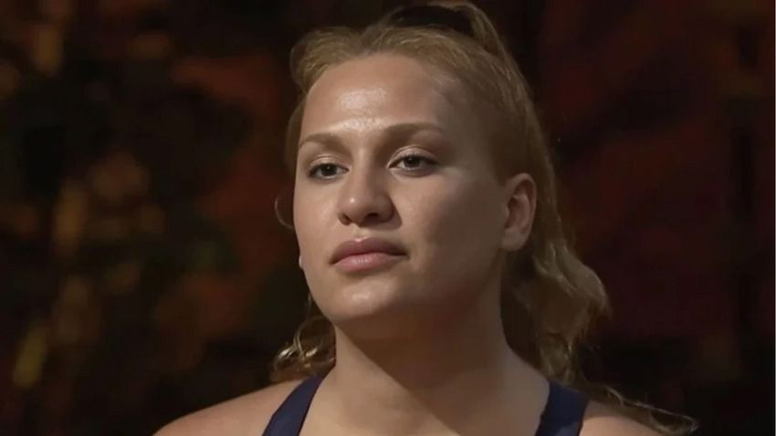 Survivor'dan diskalifiye edilmişti... Almeda Baylan’dan estetik sonrası ilk kare... - Sayfa 2
