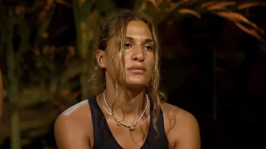 Survivor'dan diskalifiye edilmişti... Almeda Baylan’dan estetik sonrası ilk kare... - Sayfa 3