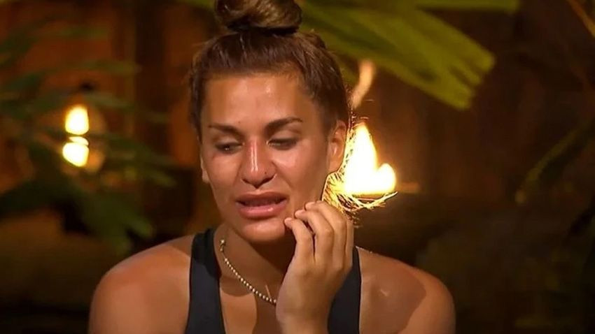 Survivor'dan diskalifiye edilmişti... Almeda Baylan’dan estetik sonrası ilk kare... - Sayfa 4