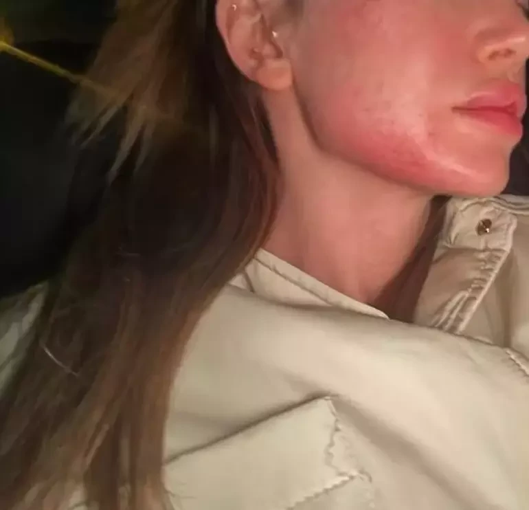 Danla Bilic’e şiddet uygulayan Berk Çetin’i bakın kim ihbar etti! - Sayfa 4