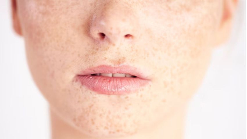 Bin yıllık reçete! İbn-i Sina’dan güneş lekelerine doğal formül - Sayfa 2