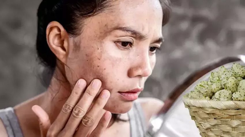 Bin yıllık reçete! İbn-i Sina’dan güneş lekelerine doğal formül - Sayfa 4