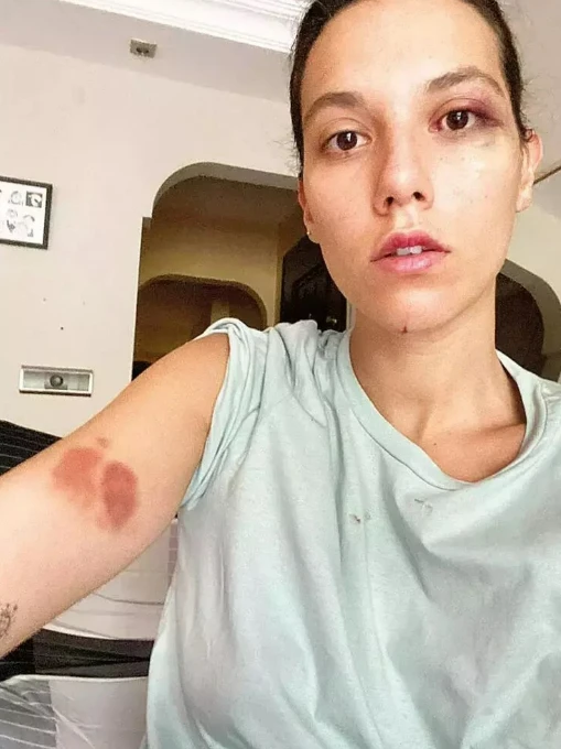 Deniz Bulutsuz Ozan Güven'e ceza sevincini paylaştı! 'Cezaevine gireceği günü bekliyorum' - Sayfa 4