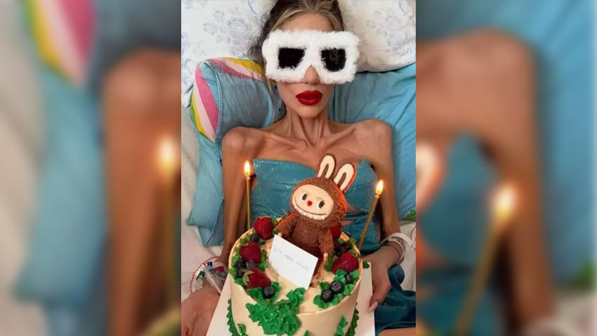 Nihal Candan’dan endişelendiren haber... Kilosu 29’un altına düştü... - Sayfa 2