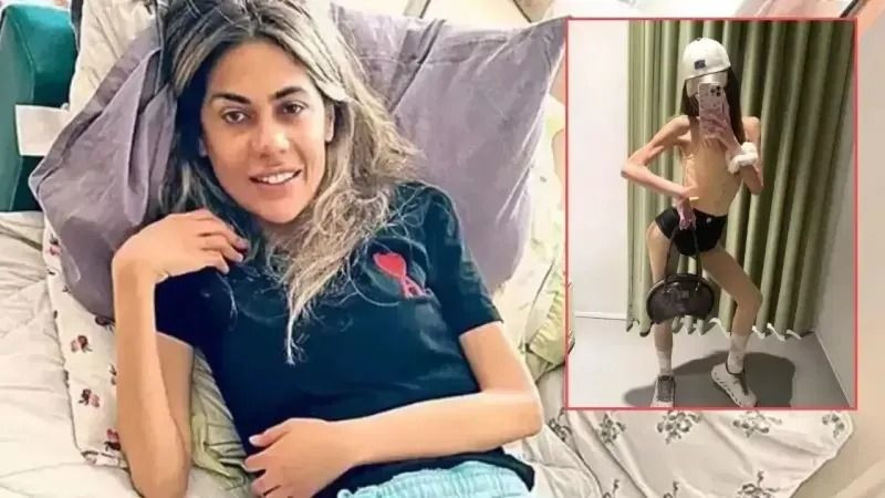 İki kez kalbi duran Nihal Candan’dan acı haber! 23 kiloya kadar düşmüştü… - Sayfa 12