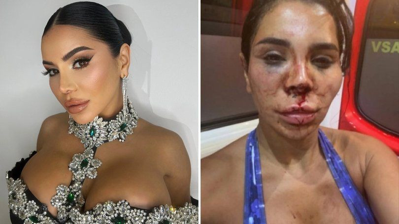 Sosyal medya fenomenine dehşet dolu saldırı! Şiddet, işkence, tecavüz... - Sayfa 1