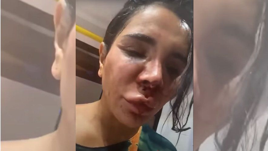 Sosyal medya fenomenine dehşet dolu saldırı! Şiddet, işkence, tecavüz... - Sayfa 2