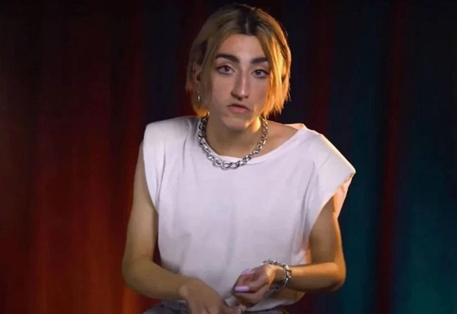 Fenomen Mika Can Raun'dan olay estetik kararı! "Ağızıma büyükmüş..." - Sayfa 1