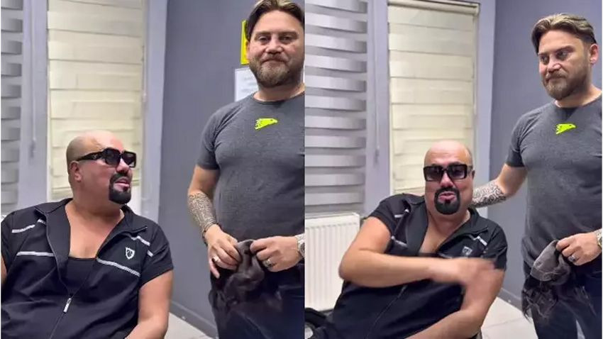 Kobra Murat peruğunu çıkardı! Saçsız halini görenler şoke oldu - Sayfa 2