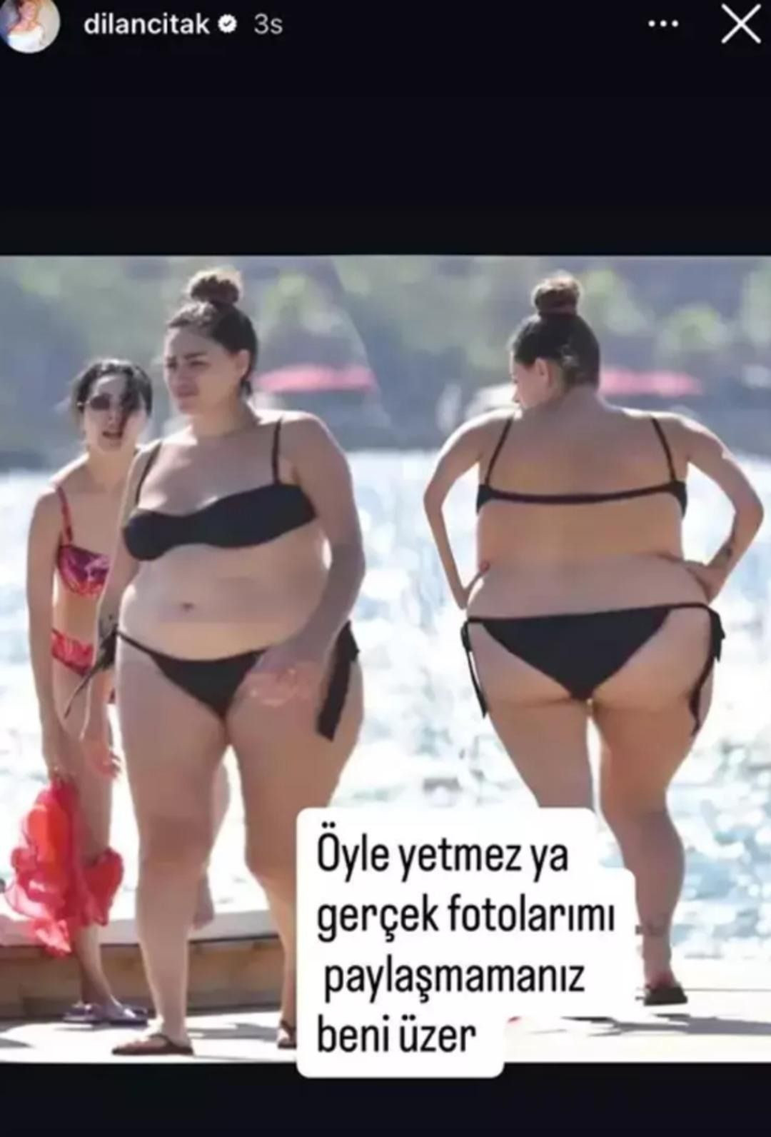 Dilan Çıtak bikinili halini görünce çileden çıktı! Bu kez muhabirlere sinirlendi - Sayfa 5