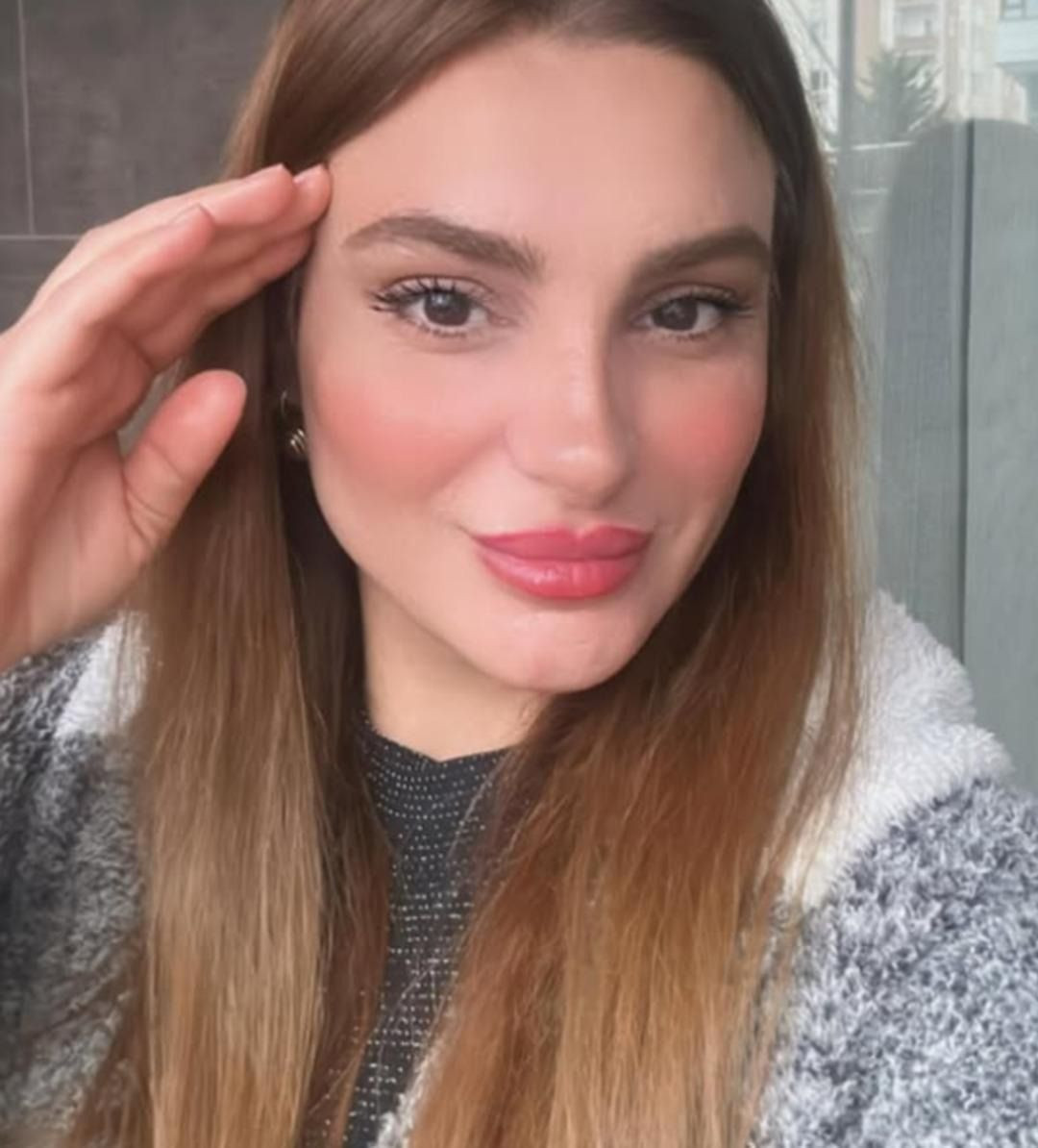 Tesettürü bıraktı, estetikle bambaşka biri oldu! Popstar Özlem’in son hali olay yarattı - Sayfa 3