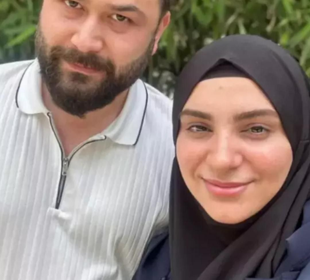 Tesettürü bıraktı, estetikle bambaşka biri oldu! Popstar Özlem’in son hali olay yarattı - Sayfa 4