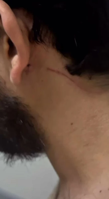 Blok3 hakkında şoke eden iddia! Kolları ve bacakları yara içinde - Sayfa 3