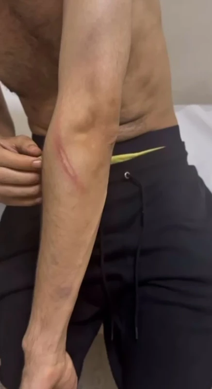 Blok3 hakkında şoke eden iddia! Kolları ve bacakları yara içinde - Sayfa 4