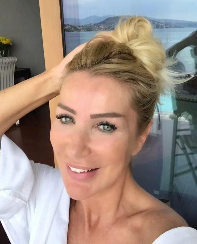 Seda Sayan’dan yıllar sonra gelen itiraf! Sır gibi sakladığı hastalığını açıkladı - Sayfa 3