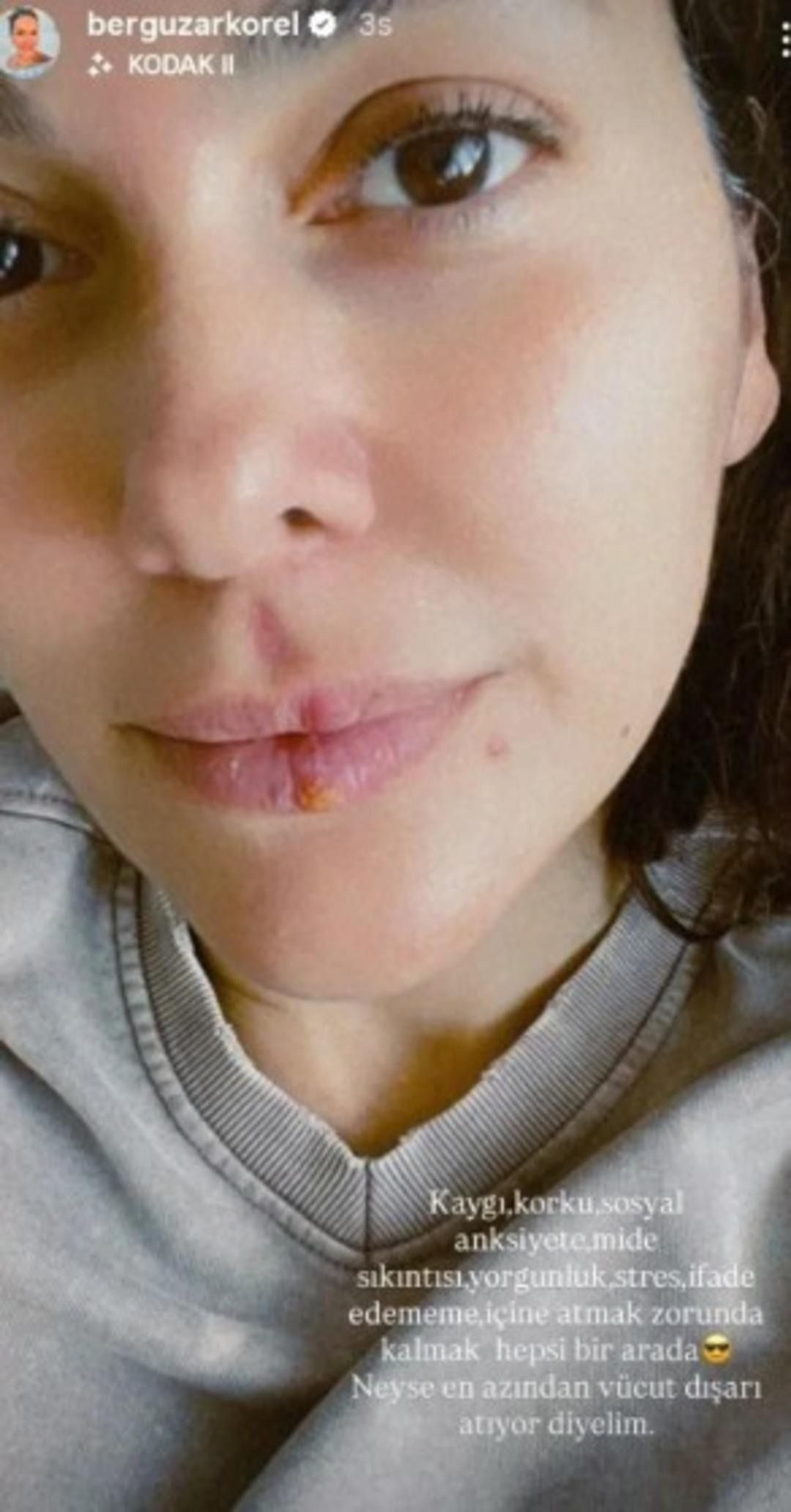 Ünlü oyuncu Bergüzar Korel makyajsız haliyle şaşırttı! O detay dikkat çekti! - Sayfa 3