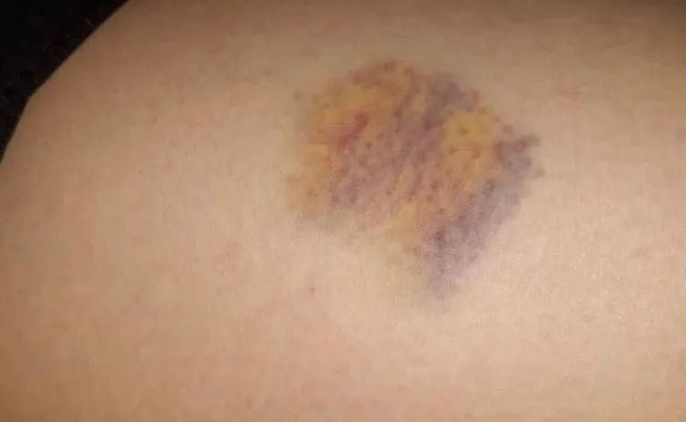 Şiddet gören kadına mahkemeden şok karar! Kıskançlığı 'kusur' sayıldı - Sayfa 4