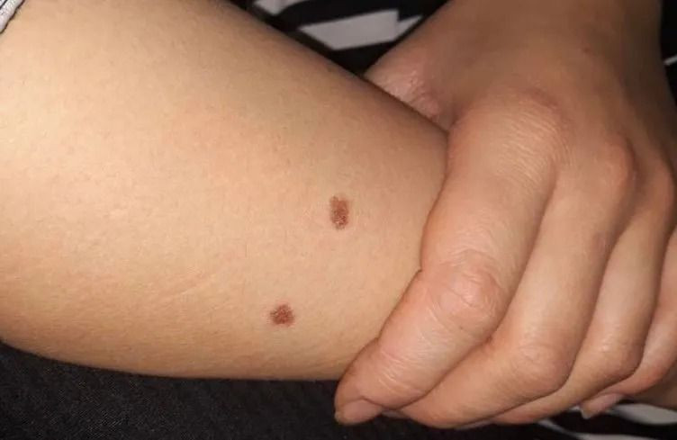 Şiddet gören kadına mahkemeden şok karar! Kıskançlığı 'kusur' sayıldı - Sayfa 2