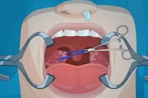 Bademcik ameliyatına 79 milyon TL'lik tazminat - Sayfa 1
