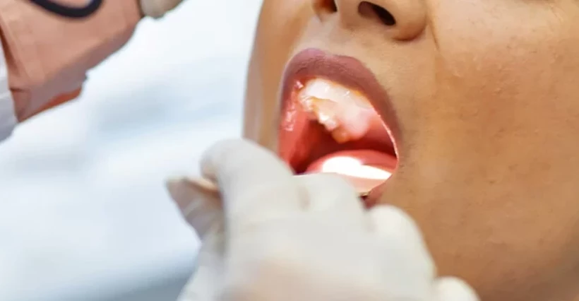 Bademcik ameliyatına 79 milyon TL'lik tazminat - Sayfa 2