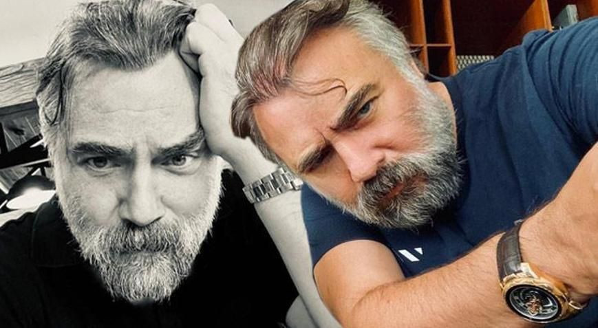 Oktay Kaynarca'dan takipçisine sert cevap! ‘Ön saç protez…’ - Sayfa 2