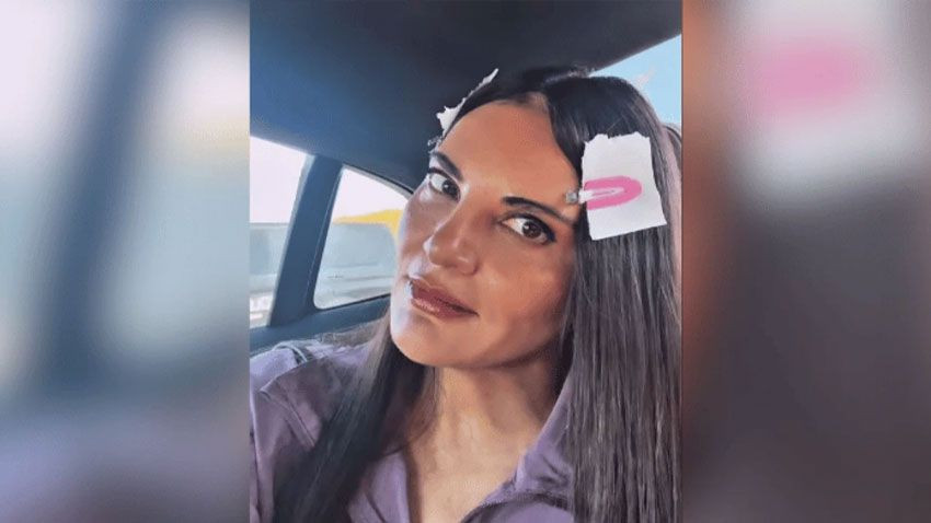 Genç görünümüyle dikkat çekti: Göksel'den doğum gününde estetik yanıtı - Sayfa 2