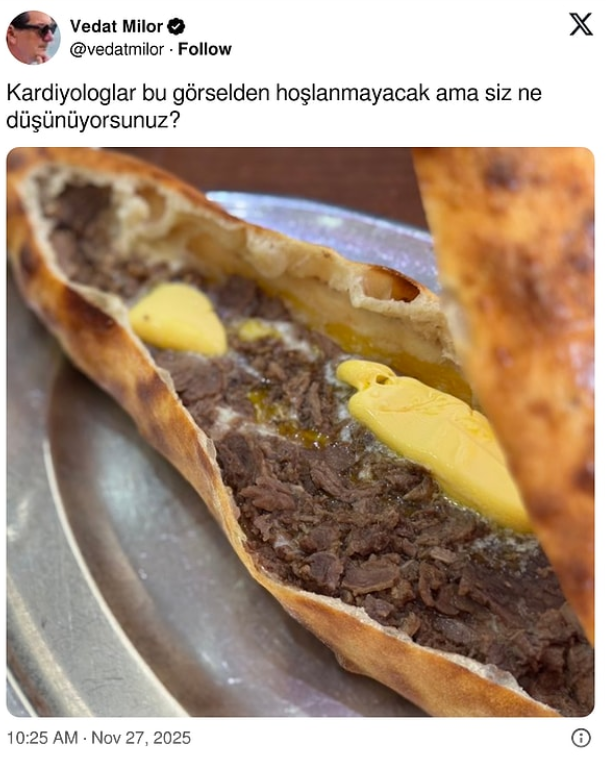 Vedat Milor’dan olay pide paylaşımı! “Doktorlar kızacak” dedi, sosyal medya yıkıldı - Sayfa 2