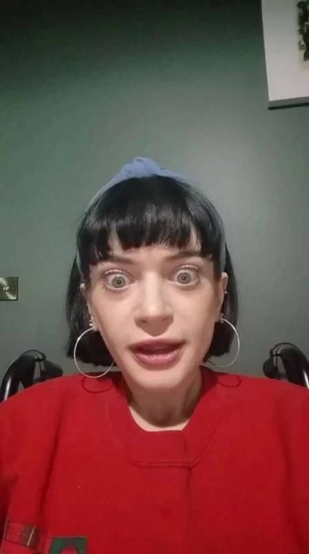 Ünlü oyuncu ikinci bacağını da kaybetti - Sayfa 4