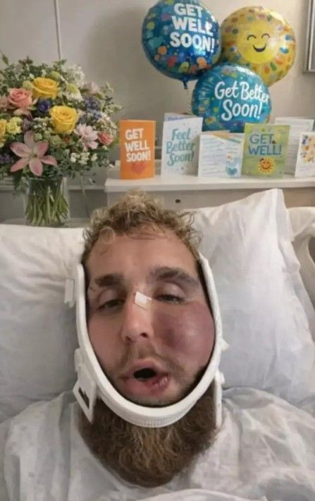 Çenesi kırıldı ama... Jake Paul saniyede 4 milyon TL kazandı - Sayfa 4