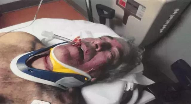 Jeffrey Epstein ölmedi iddiası sonrası yayınlandı: Boynundaki ize dikkat! - Sayfa 8