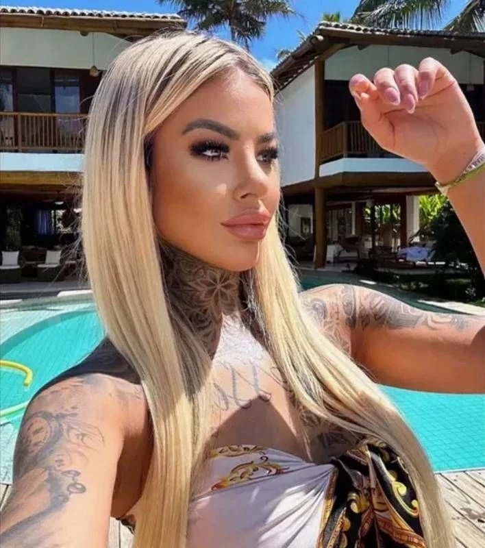 Ünlü fenomen estetik kurbanı oldu! Ameliyat sonrası hayatını kaybetti - Sayfa 6