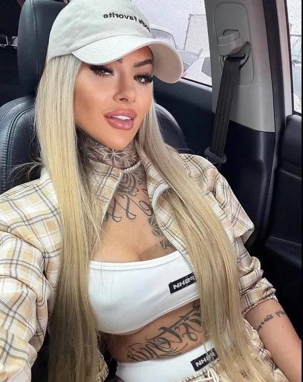 Ünlü fenomen estetik kurbanı oldu! Ameliyat sonrası hayatını kaybetti - Sayfa 7