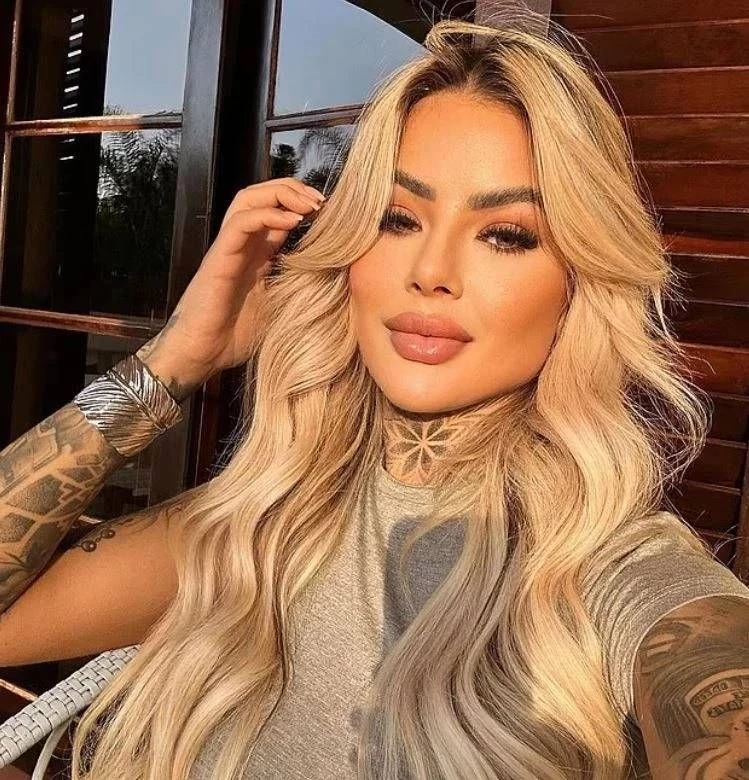 Ünlü fenomen estetik kurbanı oldu! Ameliyat sonrası hayatını kaybetti - Sayfa 4