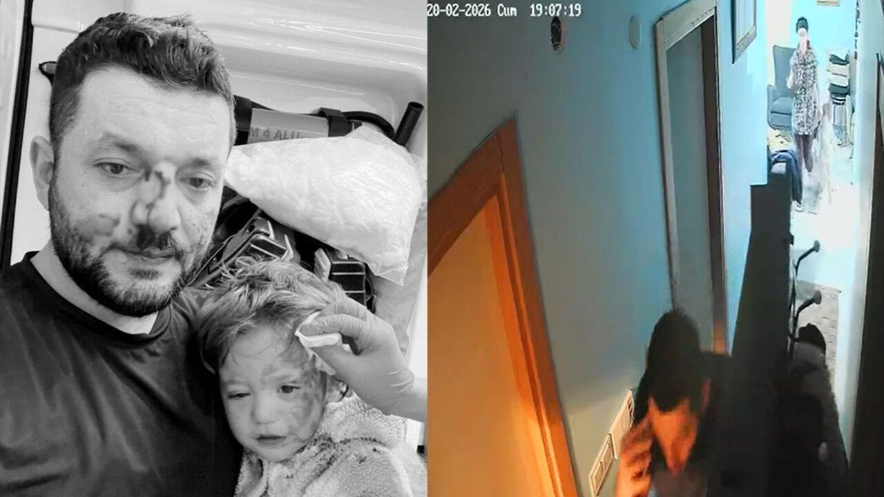 Yalova'da 14 aylık bebeği saldırı davası: 36 yıl hapis istendi, skuter silah sayıldı - Sayfa 4