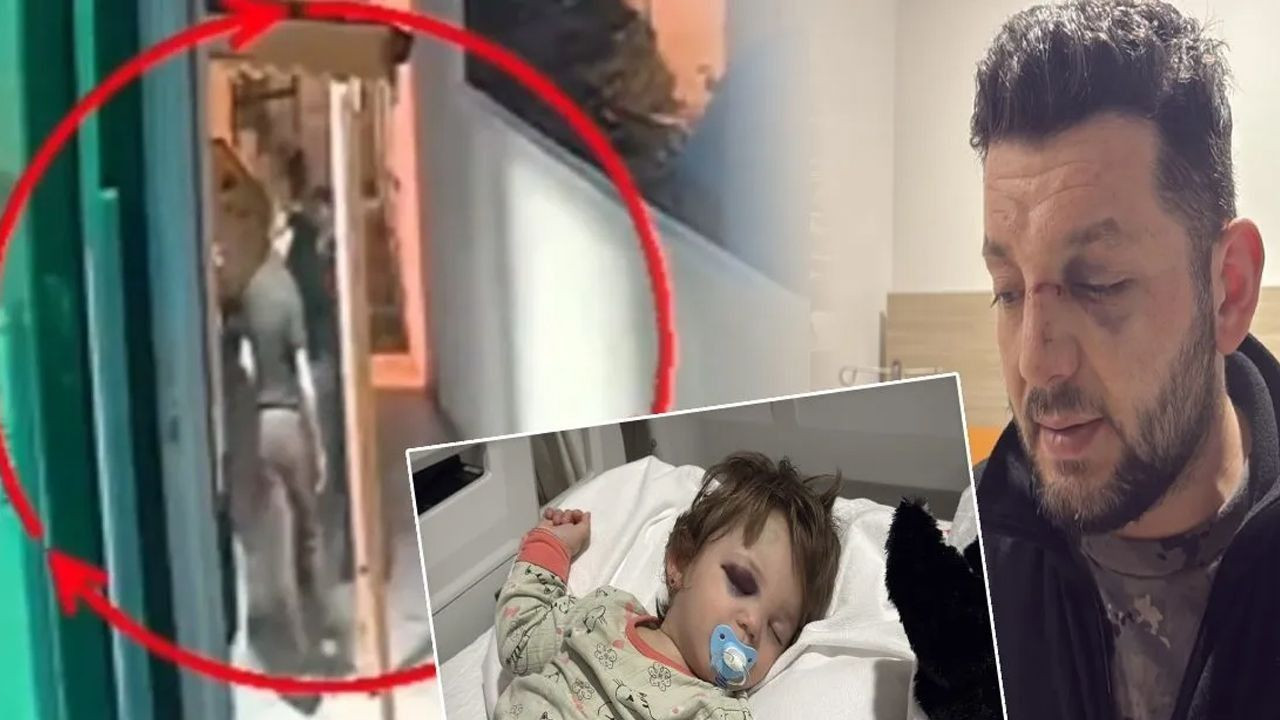 Yalova'da 14 aylık bebeği saldırı davası: 36 yıl hapis istendi, skuter silah sayıldı - Sayfa 3